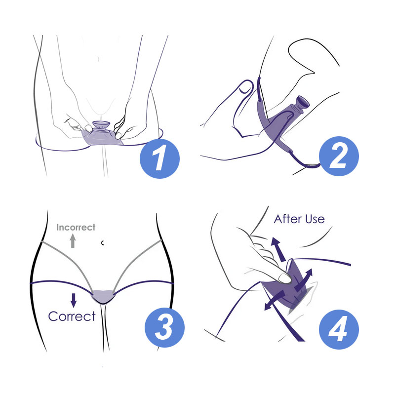 EXS Internal female condom